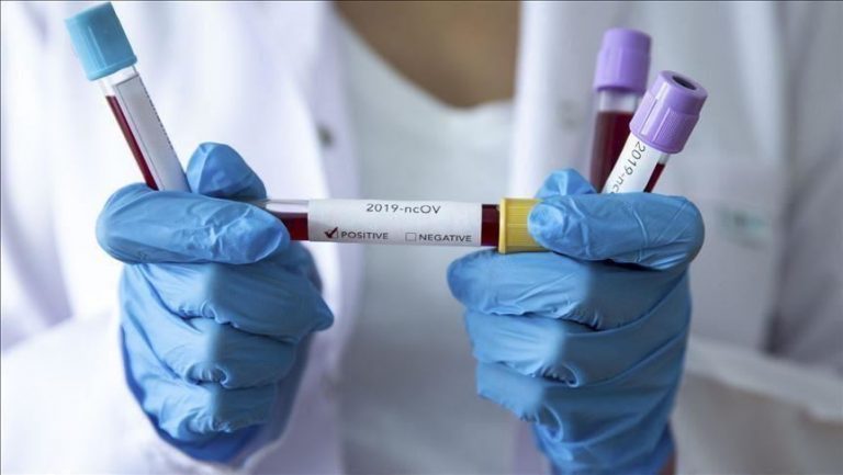koronavirus