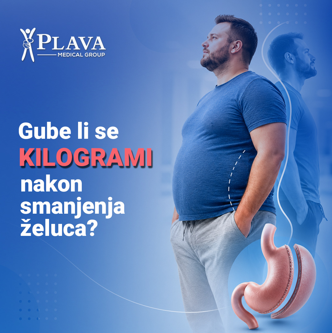Smanjenje želudca